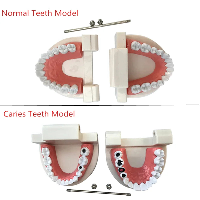 Dental Model Brushing Teeth Education Model Caries Tooth Care Oral Hygiene Studying Teaching Demonstration Dentistry Products